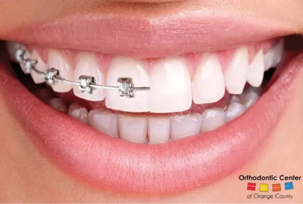 Orthodontics in Orange County